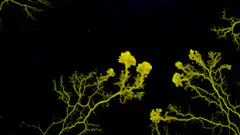 yellow branching structures on black background