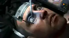 Man's eye scanned by laser