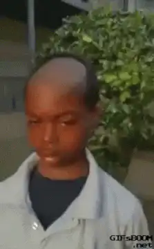 Boy turns head revealing bald spot
