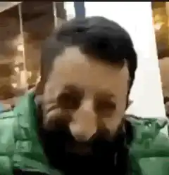 Man in green jacket rubbing nose