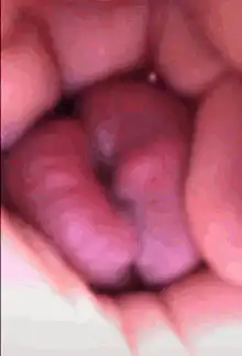 Close-up of a mouth with tongue