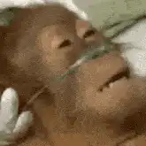 Orangutan in hospital bed with oxygen tube