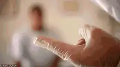 Doctor shows patient a large drop of mucus