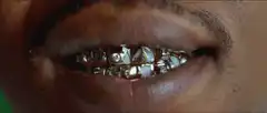 Silver to gold grillz transformation