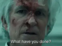 Old man with bloody face asks what have you done