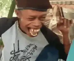 Man laughing with missing teeth