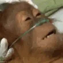 Orangutan in hospital bed with oxygen tube