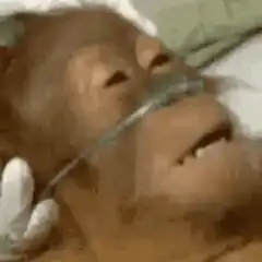 Orangutan in hospital bed