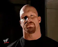 Steve Austin What?