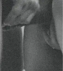 Close up of hand touching leg