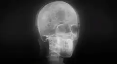 Rotating human skull x-ray