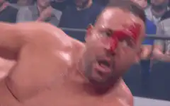 Wrestler with bloody nose
