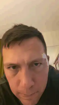 Man with white mark on face
