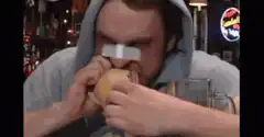 Man eating potato with bandage on nose