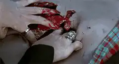 Hands pulling out a bloody heart