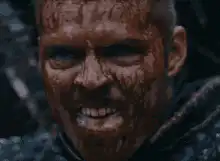 Bloodied man laughing maniacally