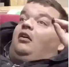 Man touching his head and looking confused