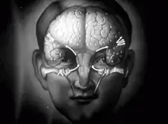 Man with exposed brain and glasses