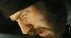 Bearded man grimacing in pain