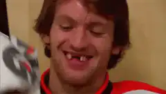 Man with broken tooth smiles