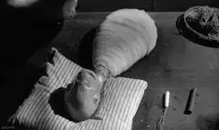 Baby with giant bandaged leg