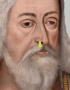 Old man with yellow booger