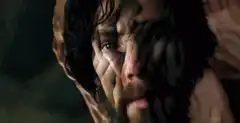 Eye worm crawling out