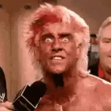Diamond Dallas Page shocked face